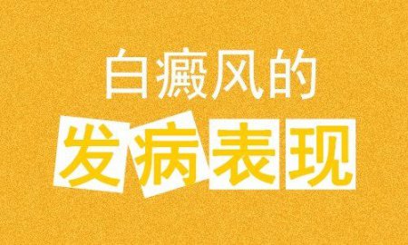 诊断白癜风需要注意的三点是什么？白癜风的诊断和治疗