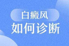 人们对白癜风这种疾病有哪些认知误区？