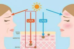 夏季日照白癜风护理如何做好防晒？
