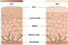 枣庄白癜风治疗方法效果为什么不同？