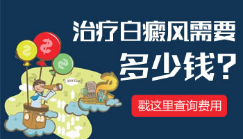 女性小腿上长块白癜风该怎么办呢？