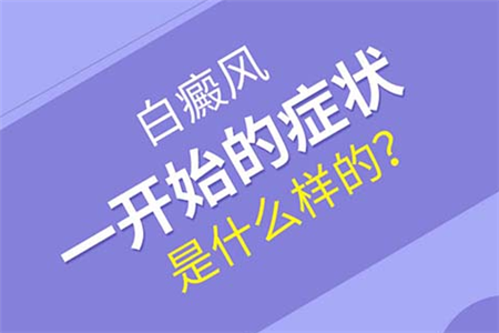 白癜风的初期发展到晚期需要多长时间？